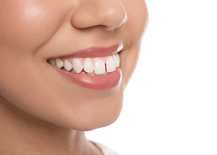 Can Clear Aligners fix an Overjet?