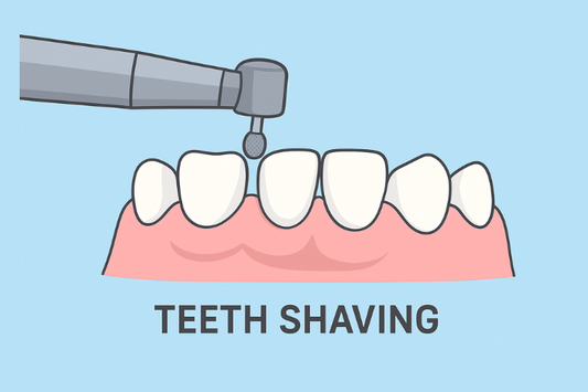 teeth shaving for veneers