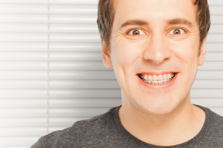 Clear Aligners & Chewing: Functional Smile Benefits