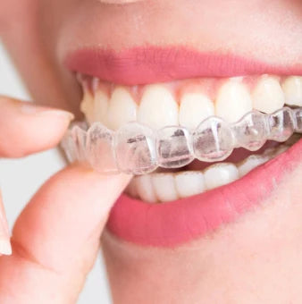 Retainers Show Best Retainers: Types, Pros, Cons & How to Choose